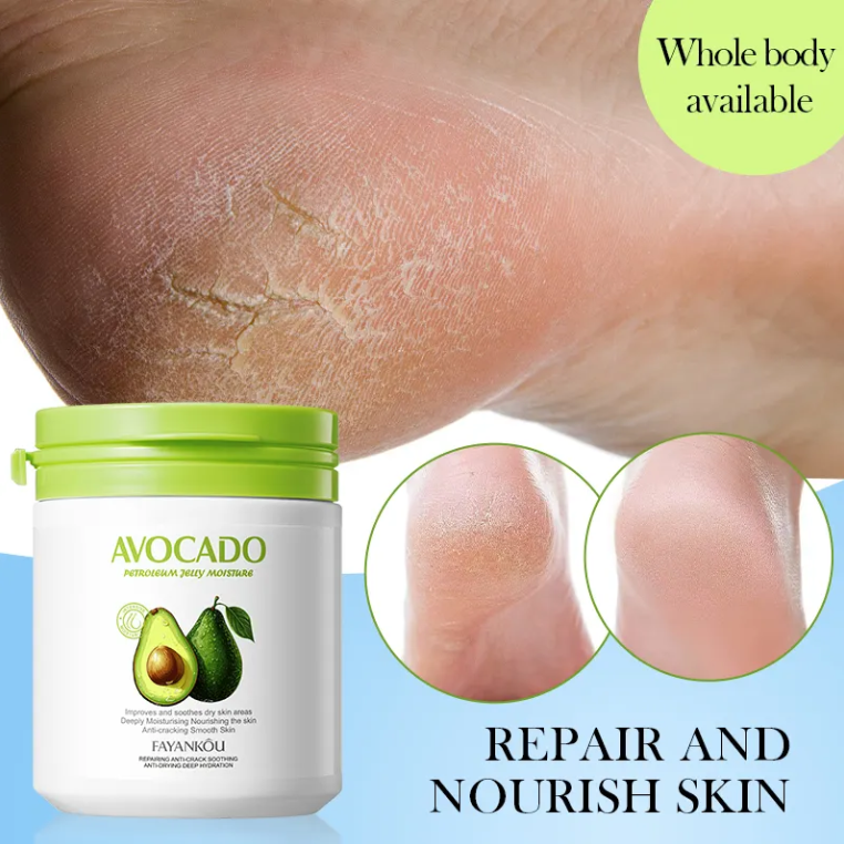 Avocado moisturizing cream for dry skin 170 ml